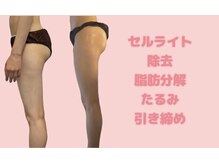 広尾痩身ビューティーサロンの雰囲気(美脚痩身【広尾痩身/シミケア/シワケア】)