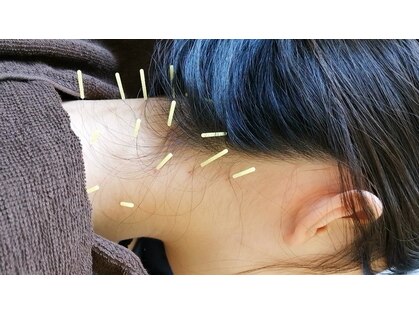 ハリキュウナチュラ(harikyuナチュラ)の写真