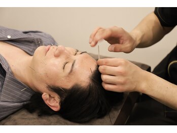 ウーシアサロン(OUSIA SALON)の写真/デキる男の新常識!美容鍼で手に入れるシャープな小顔☆たるみ改善でビジネスに圧倒的な自信を◎