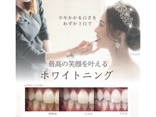 ホワイトニング専門店BRILLER 久屋大通店【7月NEW OPEN（予定）】の雰囲気（【挙式直前OK】花嫁美容の中で１番の垢抜け効果/ホワイトニング）