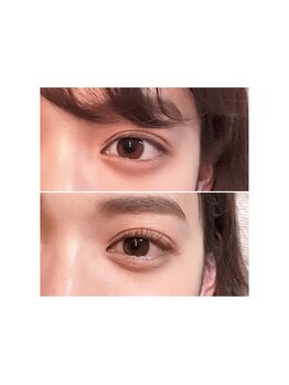 チャーミング(Charm Wink)/