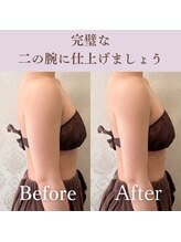 ビュール 銀座(BeauL)/ブライダルエステ