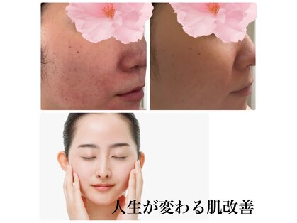 クリニカルエステ(Salon de LOMA reve beaute)の写真