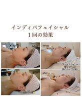 エステティック ブランシュール(Blancheur)/インディバフェイシャル90分