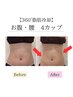 【☆ゲリラクーポン☆まだ間に合う！脂肪冷却４カップ】￥16,800　