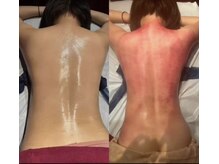 マーズ(Mars)/脂肪セル撃退