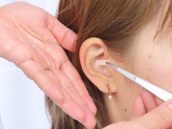 アンブロシア(Ambrosia)