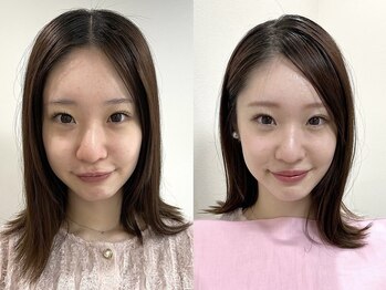 ウル 新宿代々木店(ULU)/ピンクメイクが可愛すぎる！