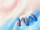 ぷっくりネイル