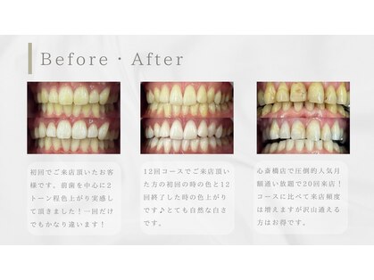 ホワイトニングバー 心斎橋オーパ店の写真