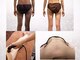 ビーエムビー(BMB)の写真/確かな結果と技術でサポート！本気のお尻痩せ＆太ももケアで理想のボディへ♪