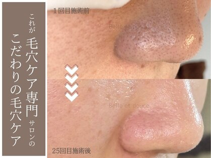 ベルエドゥース(Belle et Douce)の写真