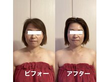 ママリラ(Mamarela)の雰囲気（小顔矯正ヘッドと巻き込肩ケアで首肩もスッキリ自信溢れる自分へ）