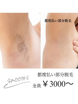スムース イー(Smooth+E)/【都度払い脱毛】好きな部位毎に