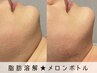 【次世代レモンボトル】75分★毛穴洗浄+導入+脂肪分解 (29,400→12,800円)
