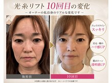 リプラス(Replus)