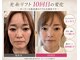 リプラス(Replus)の写真
