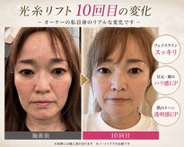 リプラス(Replus)