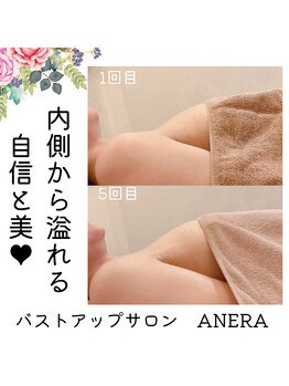 アネラ(ANERA) 心斎橋/30代2児のママ/産後萎縮悩み3