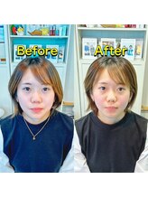 代々木美容鍼灸サロン さくら/美容鍼　before　after