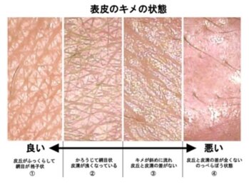 サロン リノ(Salon Lino)/肌質診断