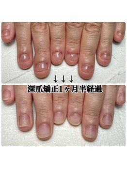 深爪ほどよく伸びる