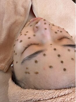 ノイ(Noi)の写真/【本気で肌質改善したい方◎】最先端美肌ピーリング施術のエピダーマルスキンで、肌のハリツヤ弾力アップ♪