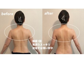 リラクゼーションエステ アジュール(Azur)/【施術1回】