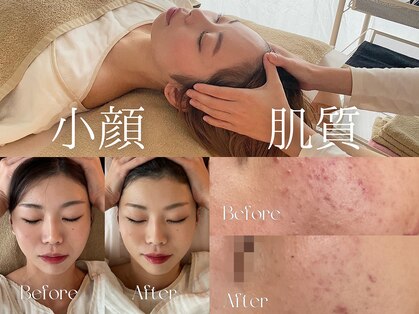 ティセ(TisseR)の写真