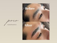 ポコ(poco)/ブロウリフト