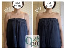 キュープ 福岡天神店(Qpu)/巻き肩コース１回での変化