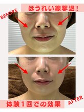 ユーフォリア(Euphoria)/体験だけで、この効果！