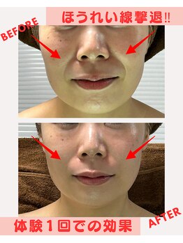 ユーフォリア(Euphoria)/体験だけで、この効果!