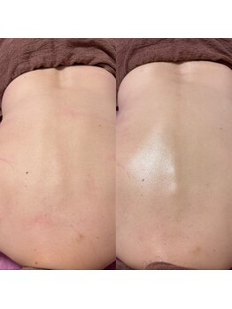 エス(S)/60代背中