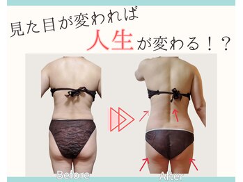 ヨサパーク リノ(YOSA PARK Lino)