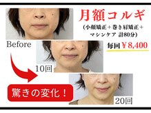 メディカルエステティックサロン リラックスイン(Relaxinn)