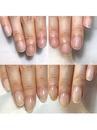 剥離爪でも縦長で美しい爪