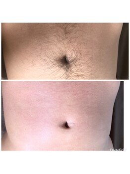 マイレ 銀座(MAILE)/お腹