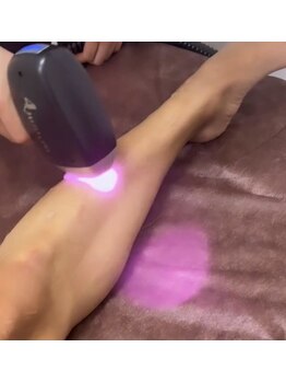 エミアンジュ(Emi Ange)/メンズ脱毛/痛みに弱い方も安心