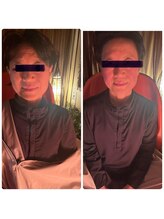 ヨサパーク セルヴィ(YOSA PARK セル美)/ルルオン＋水素酸素吸入1回で！