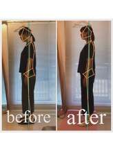 東京G整体/首矯正ビフォーアフター◎