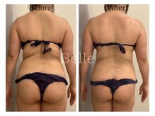 ベル 南船場店(Belle)の雰囲気（1回の痩身技術!モデルが支持する結果重視ダイエットエステ）