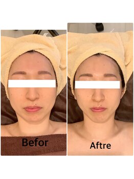 スペチアーレ 夙川/劇的ビフォーアフター