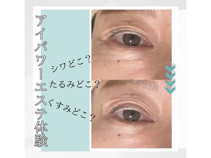 リヒト(Licht)の写真