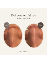 サロンアールミヨン(Salon R Miyon)/韓国式3D毛穴洗浄