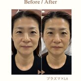 フラワー(FLOWER)