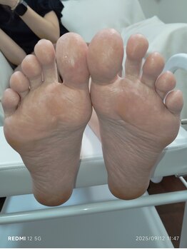 フットケアトップコート仕上げ