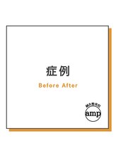 アンプ(amp)/症例/整体/肩こり/腰痛/股関節