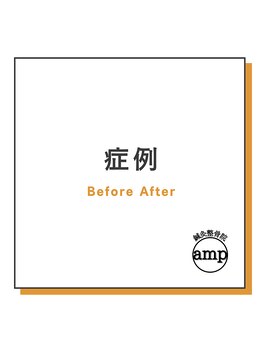 アンプ(amp)/症例/整体/肩こり/腰痛/股関節