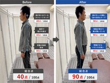 楽笑楽整体院/姿勢改善/肩こり改善/腰痛改善